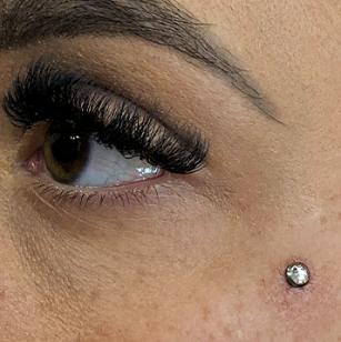Microdermal